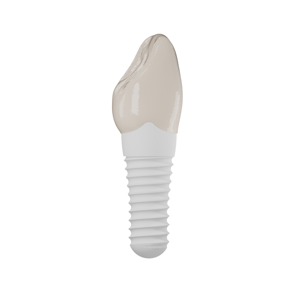 Side with crown