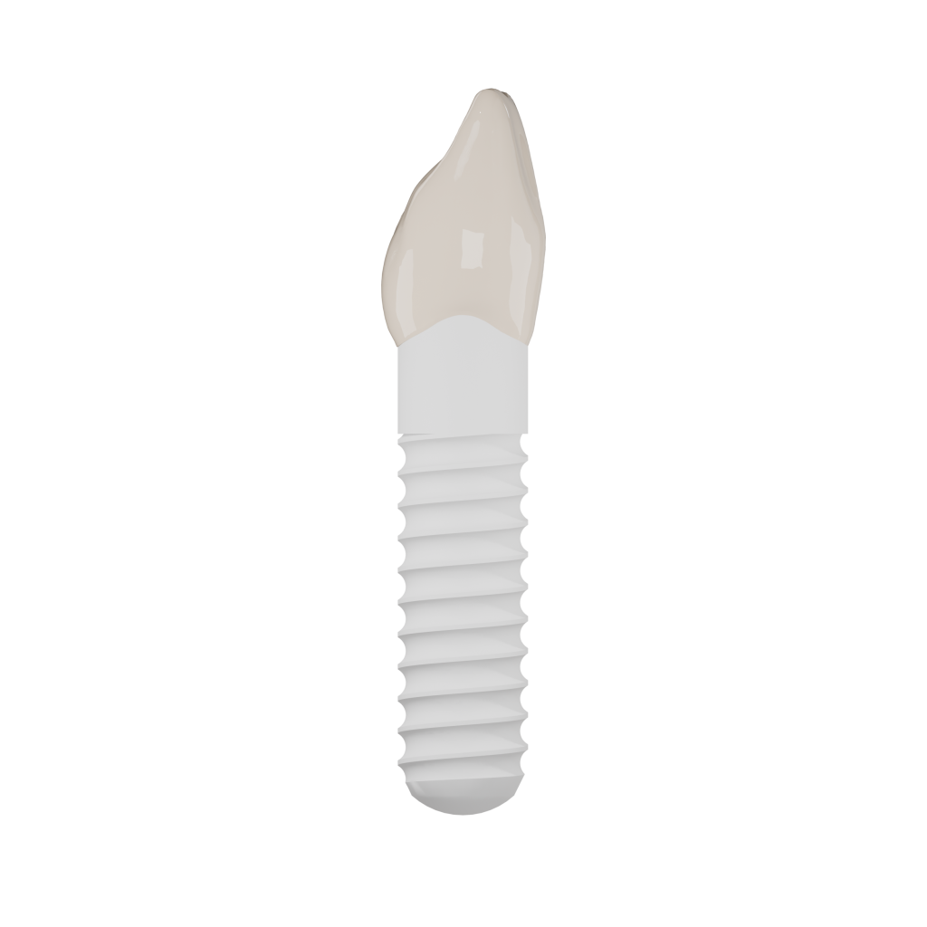 Side with crown