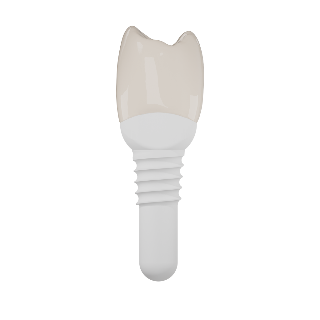 Side with crown
