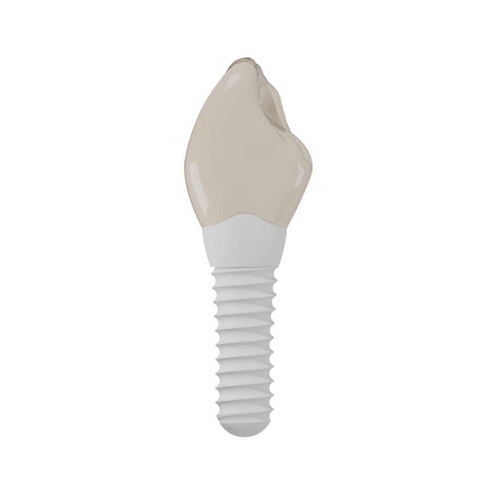 Side with crown